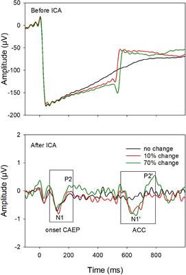 The Acoustic Change Complex in Response to Frequency Changes and Its Correlation to Cochlear Implant Speech Outcomes